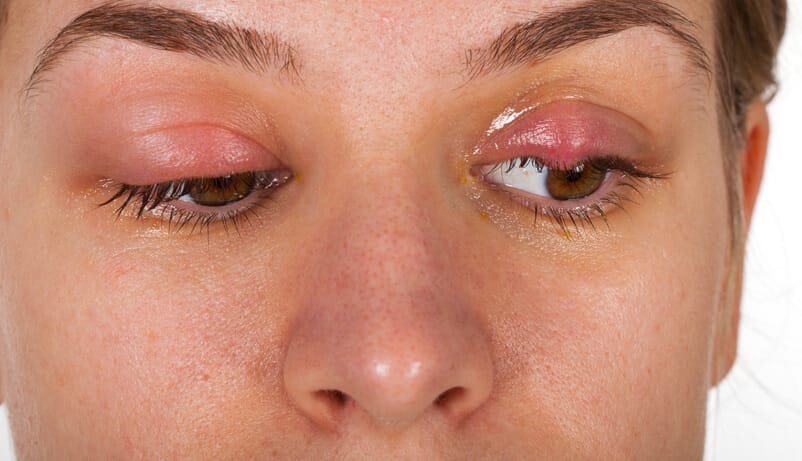 Eye doctor shares why you should avoid waterproof makeup